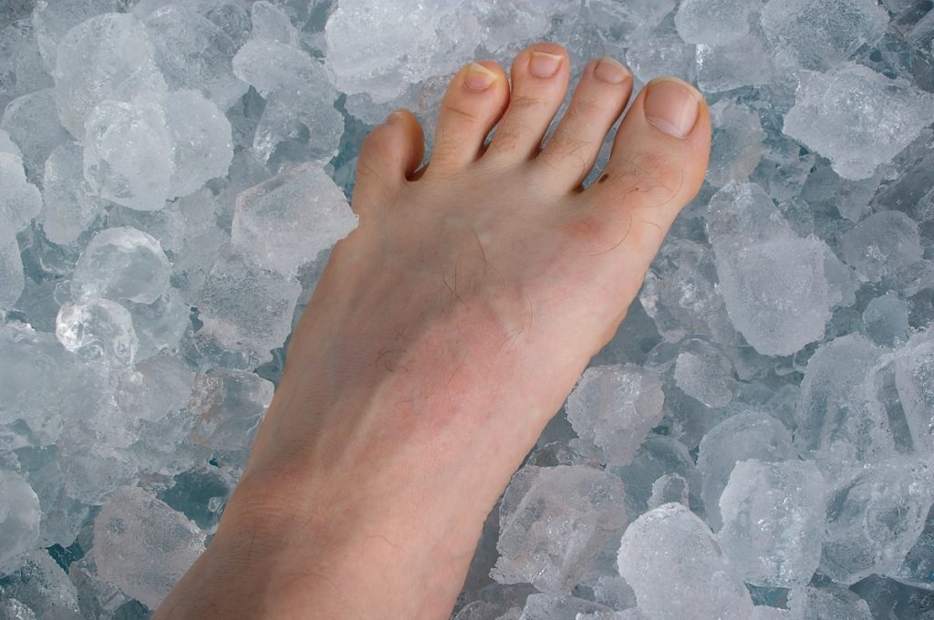 Sore ankle on ice
