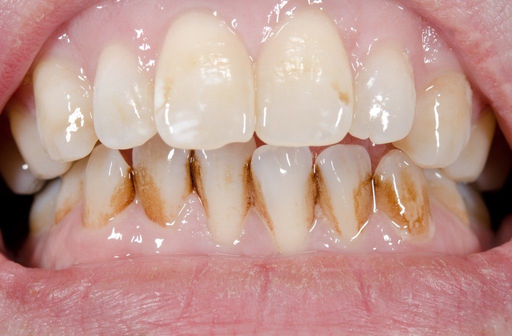 a set of browning teeth